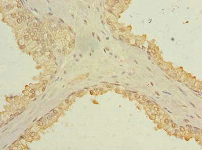 TSACC Antibody