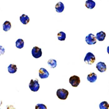 TSC2 Antibody