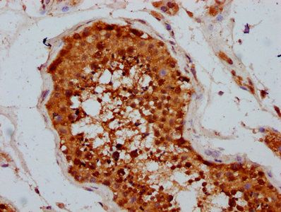 TSEN15 Antibody