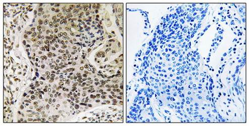 TSEN54 Antibody