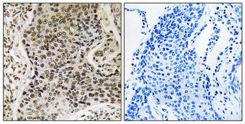 TSEN54 antibody