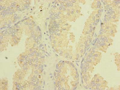 TSGA10 Antibody