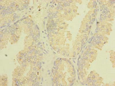 TSGA10 antibody