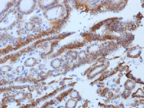 TSHR Antibody
