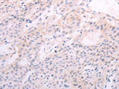 TSHR Antibody