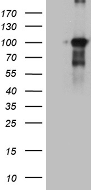 TSHZ1 Antibody