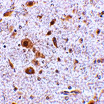 TSLP Antibody