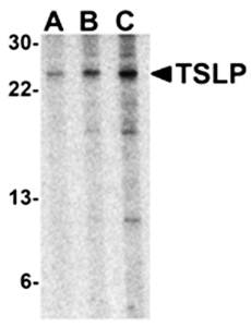 TSLP Antibody