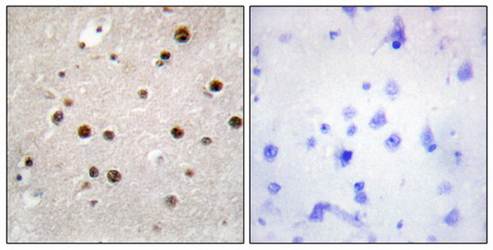TSN Antibody