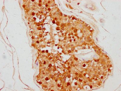 TSNAX Antibody