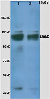TSP-1 antibody