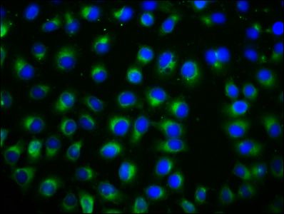 TSPAN12 Antibody