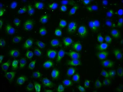 TSPAN12 antibody