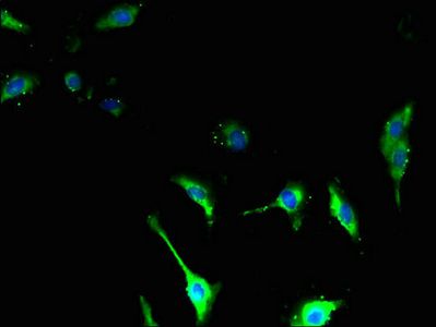 TSPAN14 Antibody