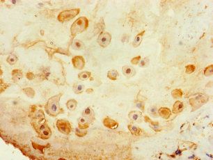TSPAN14 Antibody