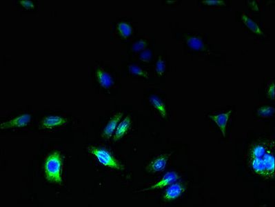 TSPAN31 Antibody