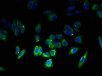 TSPAN6 antibody