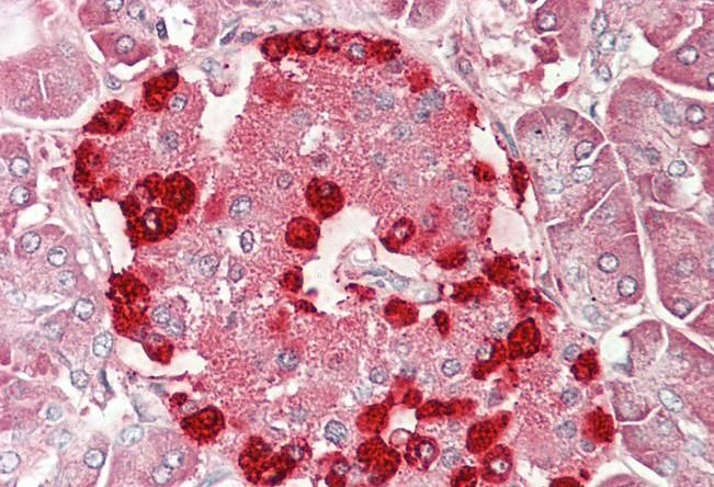 Goat anti-TSPYL2 (aa441-454) Antibody