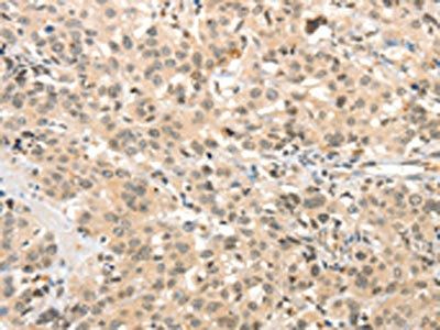 TSPYL2 Antibody