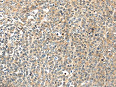 TSPYL6 Antibody