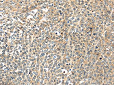 TSPYL6 antibody