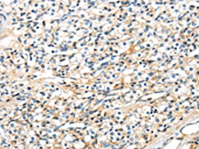 TSPYL6 Antibody