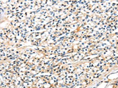 TSPYL6 antibody