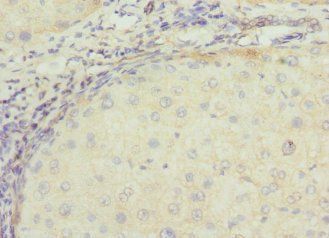 TSSK3 Antibody