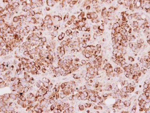 TST antibody