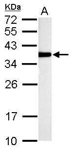 thiosulfate sulfurtransferase Antibody