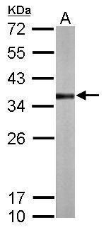 thiosulfate sulfurtransferase Antibody