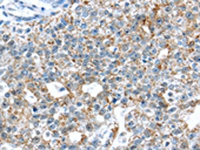 TTBK1 Antibody