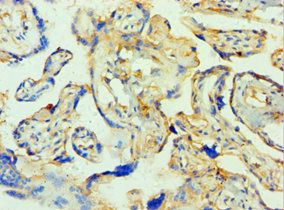 TTBK2 Antibody