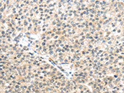 TTBK2 antibody