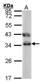 tetratricopeptide repeat domain 1 Antibody