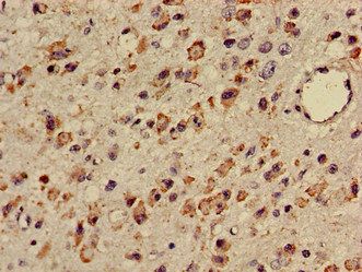 TTC27 Antibody