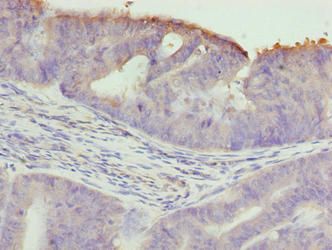 TTC30A Antibody