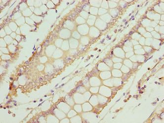 TTC30A Antibody