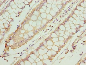 TTC30A antibody