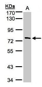 TTC30A antibody