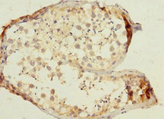 TTC32 antibody