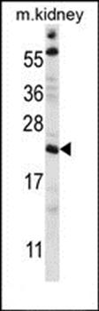 TTC33 antibody