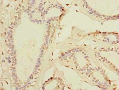 TTC33 Antibody