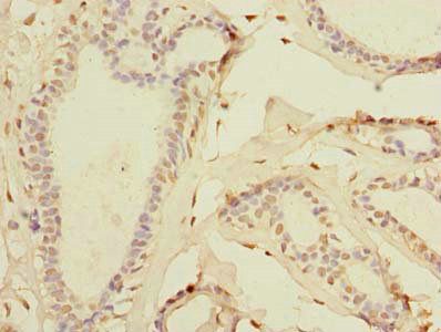 TTC33 antibody