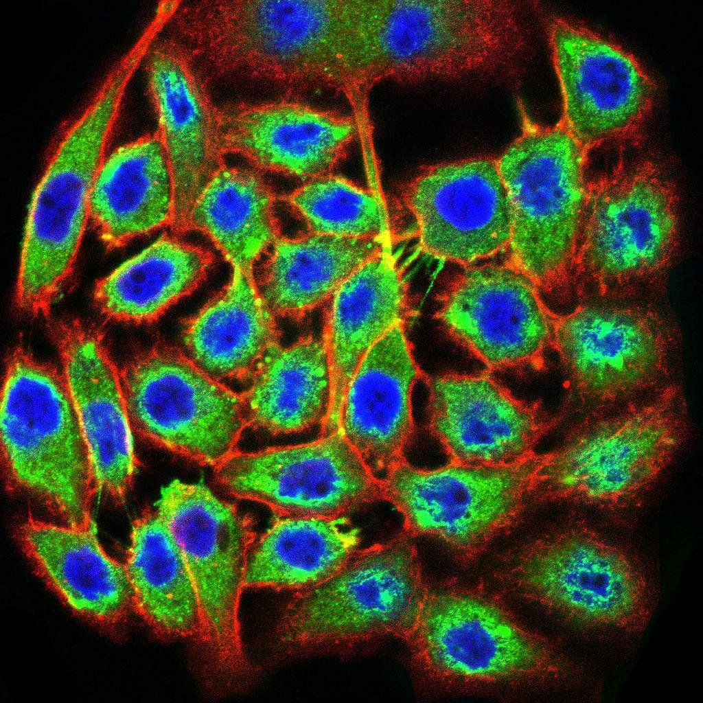 TTF1 Antibody