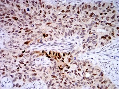 TTF1 Antibody