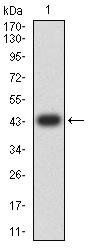 TTF1 Antibody