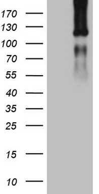 TTF1 Antibody