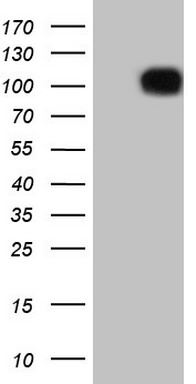 TTF1 Antibody
