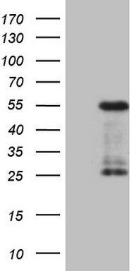 TTF1 Antibody